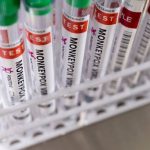 monkeypox-test